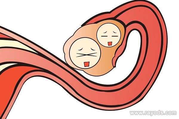 厦门代孕过程全方位保密-代孕辅助生殖中心包成功_闭锁卵泡发生在哪个阶段